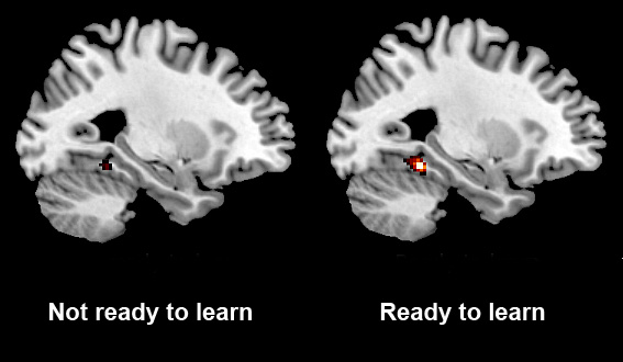 brain-learning
