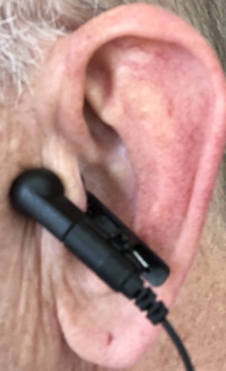 Non-Invasive Vagus Nerve Stimulator Attached to the Auricular Concha via Ear Clip